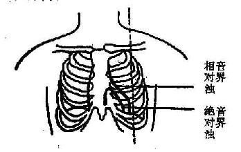 心脏的绝对浊音界和相对浊音界示意图