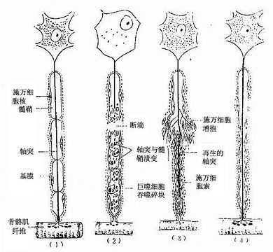 周围神经的溃变与再生图解 